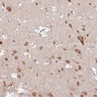 Immunohistochemistry-Paraffin: UGCGL2 Antibody [NBP2-13503]