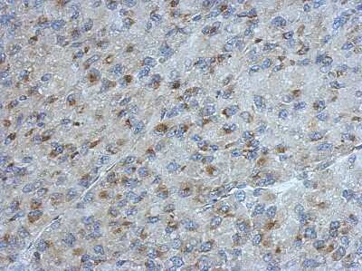 Immunohistochemistry-Paraffin: UGCGL2 Antibody [NBP2-20803]