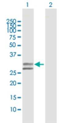 Western Blot: UGCGL2 Antibody [H00055757-D01P]