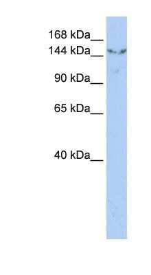 Western Blot: UGCGL2 Antibody [NBP1-79299]