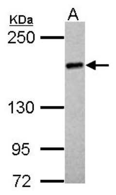 Western Blot: UGCGL2 Antibody [NBP2-20803]