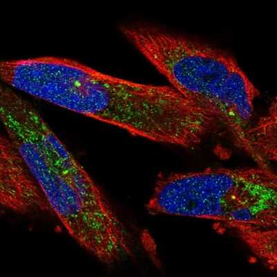 Immunocytochemistry/ Immunofluorescence: UGP2 Antibody [NBP2-49427]