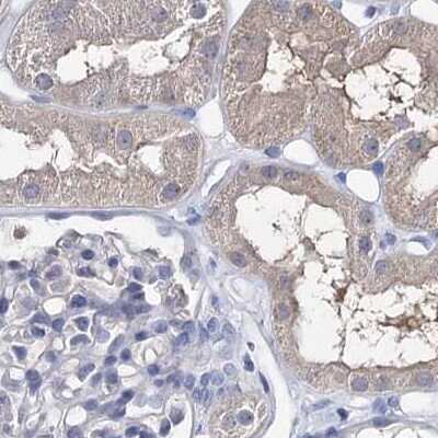 Immunohistochemistry-Paraffin: UGP2 Antibody [NBP1-85918]