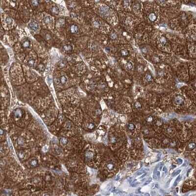 Immunohistochemistry-Paraffin: UGP2 Antibody [NBP1-85918]