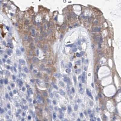 Immunohistochemistry-Paraffin: UGP2 Antibody [NBP1-85918]