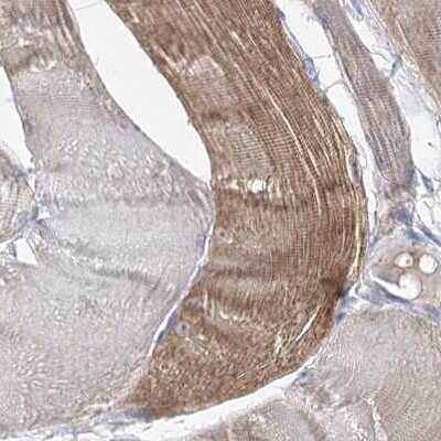 Immunohistochemistry-Paraffin: UGP2 Antibody [NBP1-85918]