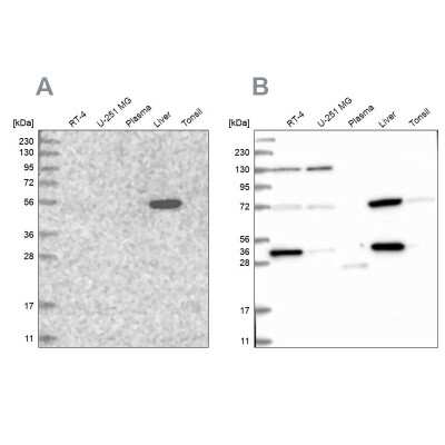 Western Blot: UGP2 Antibody [NBP1-85918]