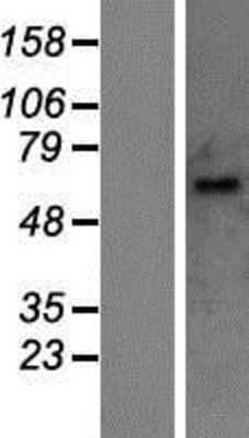 Western Blot: UGT1A10 Overexpression Lysate [NBP2-06724]