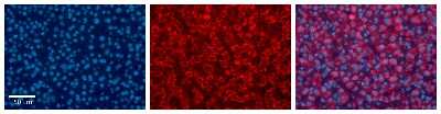 Immunohistochemistry: UGT1A6 Antibody [NBP1-69707]