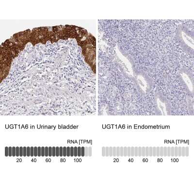 Immunohistochemistry-Paraffin: UGT1A6 Antibody [NBP2-49113]