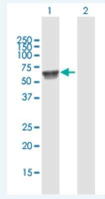 Western Blot: UGT1A7 Antibody [H00054577-B01P-50ug]