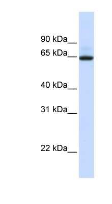 Western Blot: UGT1A7 Antibody [NBP1-91335]