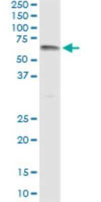 Immunoprecipitation: UGT1A9 Antibody (1A2) [H00054600-M04]