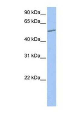 Western Blot: UGT2A3 Antibody [NBP1-69615]