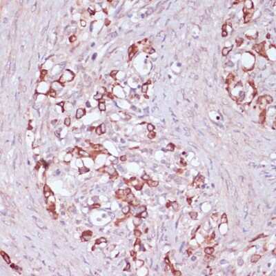 Immunohistochemistry-Paraffin: UGT2B15 Antibody - Azide and BSA Free [NBP2-94747]