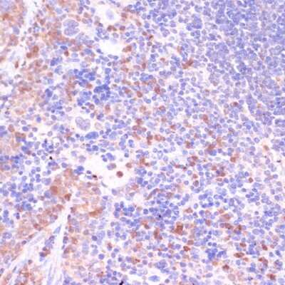Immunohistochemistry-Paraffin: UGT2B15 Antibody - Azide and BSA Free [NBP2-94747]