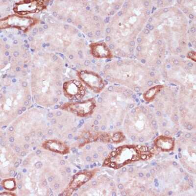 Immunohistochemistry-Paraffin: UGT2B15 Antibody - Azide and BSA Free [NBP2-94747]