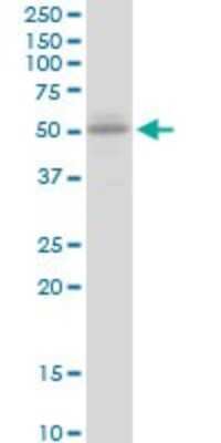 Western Blot: UGT2B15 Antibody [H00007366-B01P]