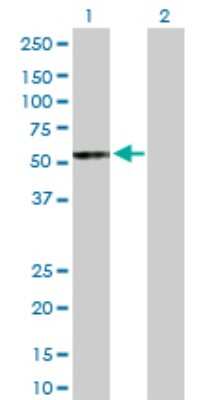 Western Blot: UGT2B15 Antibody [H00007366-D01P]
