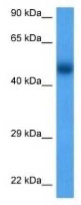 Western Blot: UGT2B17 Antibody [NBP3-09985]