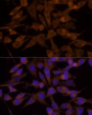 Immunocytochemistry/ Immunofluorescence: UGT2B7 Antibody - Azide and BSA Free [NBP2-94823]