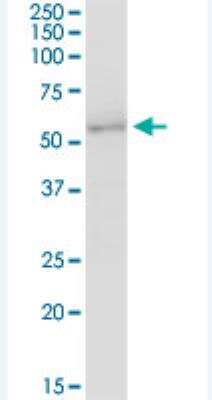 Western Blot: UGT2B7 Antibody [H00007364-B01P-50ug]