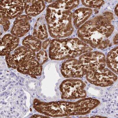 Immunohistochemistry-Paraffin: UGT3A2 Antibody [NBP2-32468]