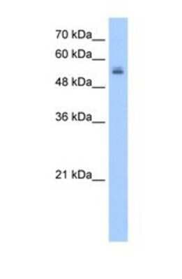 Western Blot: UGT3A2 Antibody [NBP1-69421]