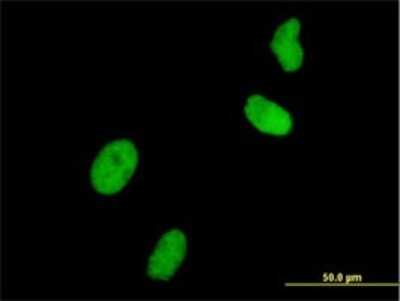 Immunocytochemistry/ Immunofluorescence: UHRF1 Antibody (3A11) [H00029128-M01]