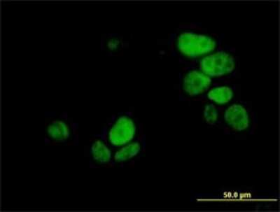 Immunocytochemistry/ Immunofluorescence: UHRF1 Antibody (3B12) [H00029128-M02]
