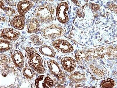 Immunohistochemistry: UIP1 Antibody (OTI1E8) - Azide and BSA Free [NBP2-74782]