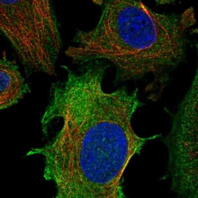 Immunocytochemistry/ Immunofluorescence: ULBP-1 Antibody [NBP2-58022]