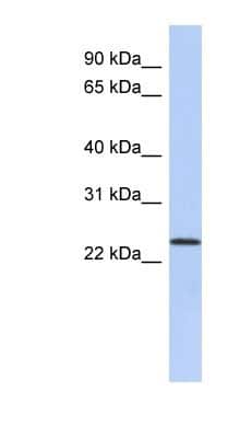 Western Blot: ULBP-1 Antibody [NBP1-59052]