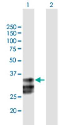 Western Blot: ULBP-2 Antibody [H00080328-B01P]