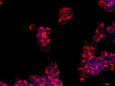 Immunocytochemistry/ Immunofluorescence: ULBP-3 Antibody [NBP2-31866]