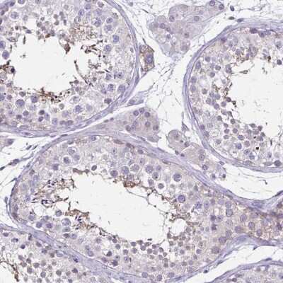 Immunohistochemistry-Paraffin: ULBP-3 Antibody [NBP2-31866]