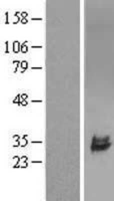 Western Blot: ULBP-2 Overexpression Lysate [NBL1-17606]