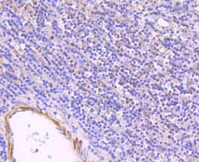 Immunohistochemistry-Paraffin: ULK1 Antibody (JA58-36) [NBP2-66765]