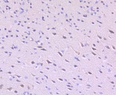 Immunohistochemistry-Paraffin: ULK1 Antibody (JA58-36) [NBP2-66765]