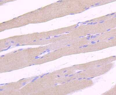 Immunohistochemistry-Paraffin: ULK1 Antibody (JA58-36) [NBP2-66765]