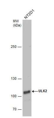 Western Blot: ULK2 Antibody [NBP1-33136]
