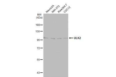 Western Blot: ULK2 Antibody [NBP1-33136]