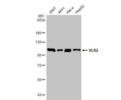 Western Blot: ULK2 Antibody [NBP1-33136]