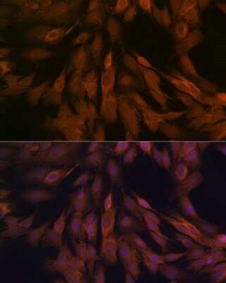 Immunocytochemistry/ Immunofluorescence: ULK3 Antibody (5Z7Z6) [NBP3-16622]