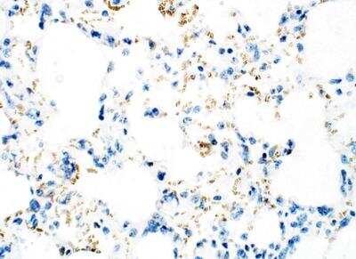 Immunohistochemistry-Paraffin: ULK3 Antibody [NBP3-12363]