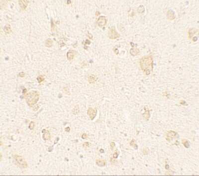Immunohistochemistry: ULK4 Antibody - BSA Free [NBP2-41244]