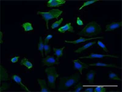 Immunocytochemistry/ Immunofluorescence: UMPS Antibody (2B10) [H00007372-M06]