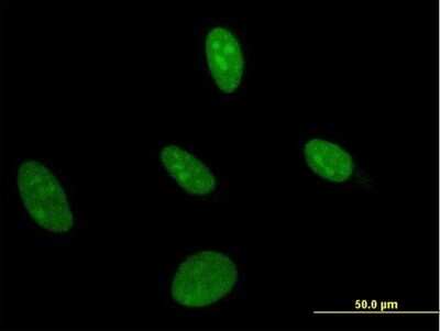 Immunocytochemistry/ Immunofluorescence: UMPS Antibody (2F5) [H00007372-M05]