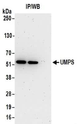 Immunoprecipitation: UMPS Antibody [NBP2-32171]