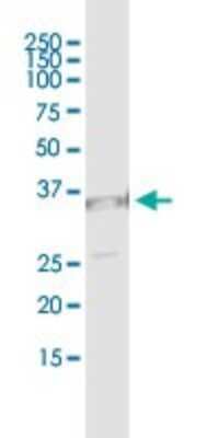 Immunoprecipitation: UNC119 Antibody (2F9-2A9) [H00009094-M01]